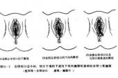 用“紧缩”造句