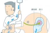用“灌洗”造句