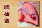 用“肺栓塞”造句
