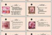 用“妇科病”造句