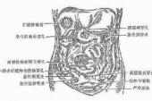 用“脑膜炎”造句